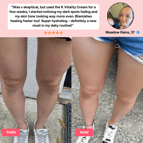 Lunara Cellulite Relief Kit